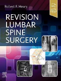 Revision Lumbar Spine Surgery E-Book by Heary, Robert F.