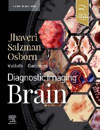 Diagnostic Imaging: Brain E-Book by Jhaveri, Miral D