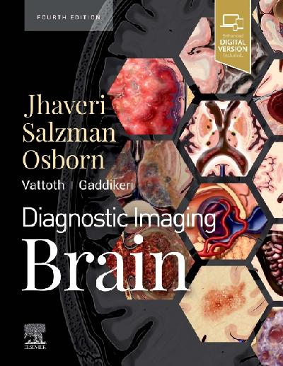 Diagnostic Imaging: Brain E-Book