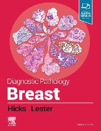 Diagnostic Pathology: Breast, E-Book by Lester, Susan C./Hicks, David G