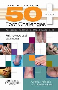 50+ Foot Challenges by Thomson, Colin/Gibson, J. N. Alastair
