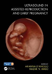 Ultrasound in Assisted Reproduction and Early Pregnancy by Amso, Nazar N./D'Angelo, Arianna