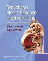Structural Heart Disease Interventions by Carroll, John D./Webb, John G.